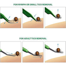 Load image into Gallery viewer, BritenWay Stainless Steel Tick Remover Set