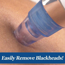 Load image into Gallery viewer, DermaSuction Blackhead Remover